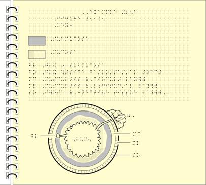 Image: Gastrointestinal Tract simbraille and tactile graphic possible modification part 2